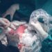 Nicaragua a la vanguardia en cirugía fetal intrauterina a nivel centroamericano